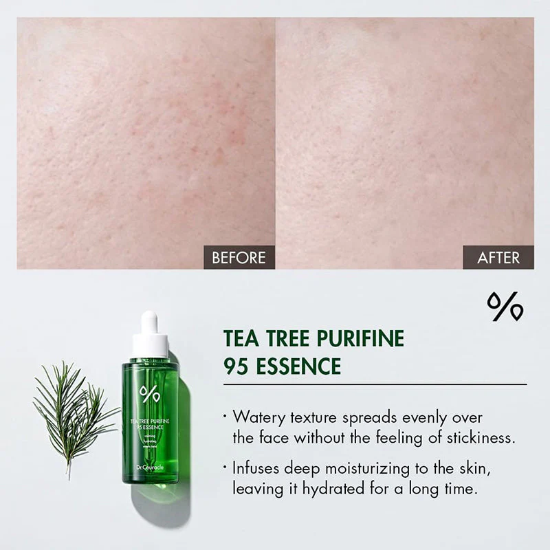 Tea Tree Purifine 95 Essence - Image 11