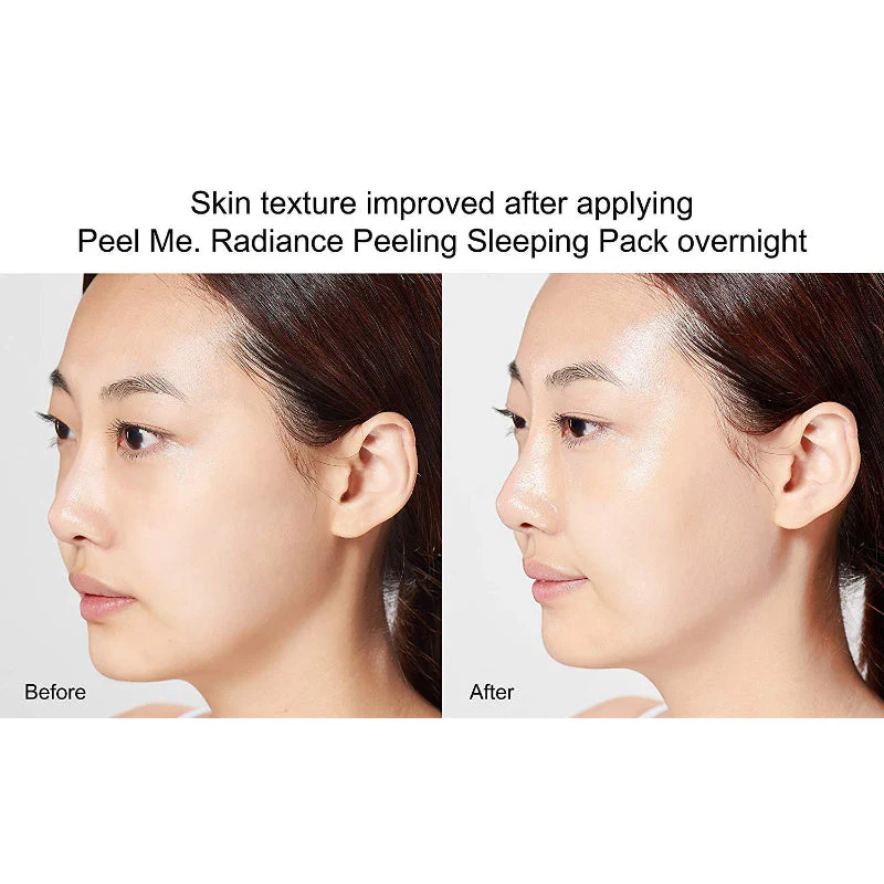 Radiance Peeling Sleeping Pack - Image 6