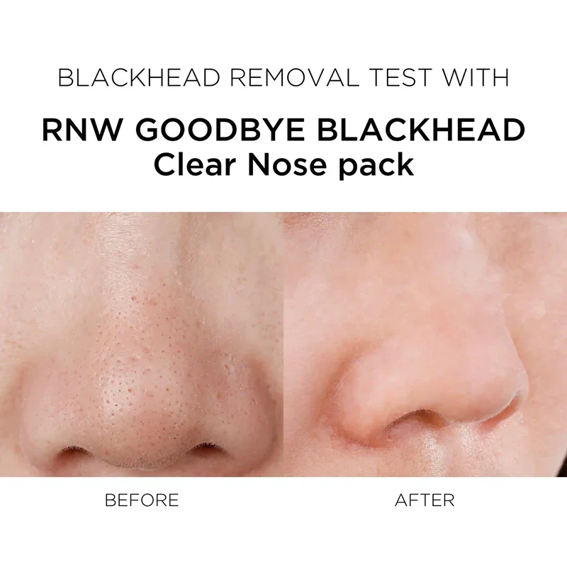2 STEP Clear Nose Pack - Image 6