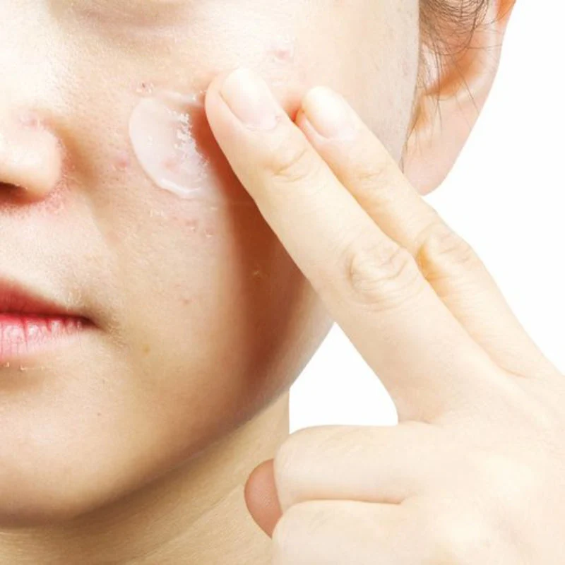 Anti-T Cream - Image 2
